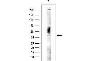 Western blot analysis of lysates from COLO205 cells, using LILR Antibody at 1/1000 dilution.