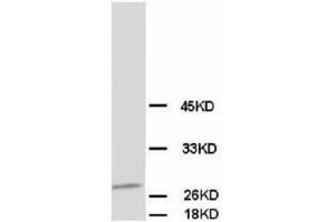 Image no. 1 for anti-Calbindin (CALB1) antibody (ABIN1502005) (CALB1 抗体)