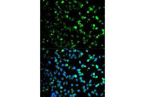 Immunofluorescence analysis of HeLa cell using TYMP antibody. (Thymidine Phosphorylase 抗体  (AA 1-200))