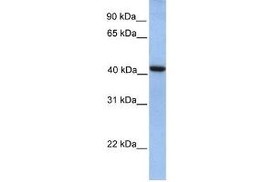 GMPPA antibody used at 1 ug/ml to detect target protein. (GMPPA 抗体  (N-Term))