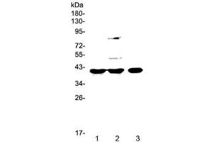 Western blot testing of 1) rat spleen, 2) rat liver and 3) mouse testis lysate with PPID antibody at 0. (PPID 抗体)