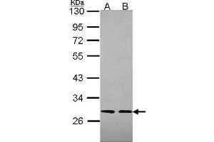WB Image Sample (30 ug of whole cell lysate) A: 293T B: A431 , 12% SDS PAGE antibody diluted at 1:2000 (SLA 抗体)