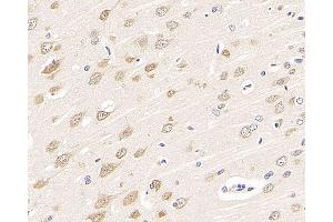 Immunohistochemistry analysis of paraffin-embedded rat brain using RBFOX3 Polyclonal Antibody at dilution of 1:300. (NeuN 抗体)