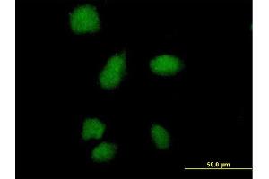 Immunofluorescence of purified MaxPab antibody to SMA4 on HeLa cell. (SMN1 抗体  (AA 1-140))