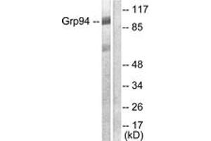 Western blot analysis of extracts from SKOV3 cells, using GRP94 Antibody.