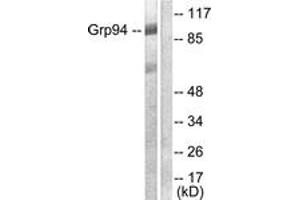 Western blot analysis of extracts from SKOV3 cells, using GRP94 Antibody. (GRP94 抗体  (AA 754-803))
