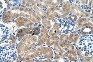 Image no. 1 for anti-Syndecan Binding Protein (Syntenin) (SDCBP) (AA 101-150) antibody (ABIN205051) (SDCBP 抗体  (AA 101-150))