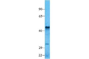 Host:  Rabbit  Target Name: SMAD7    Sample Type:  Human Lung  Antibody Dilution:  1. (SMAD7 抗体  (N-Term))