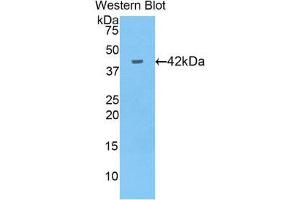 Western Blotting (WB) image for anti-Glutathione Peroxidase 4 (GPX4) (AA 74-197) antibody (ABIN1859059) (GPX4 抗体  (AA 74-197))