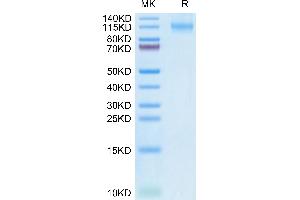 SDS-PAGE (SDS) image for Fms-Related tyrosine Kinase 3 (FLT3) (AA 27-541) protein (Fc Tag) (ABIN7274657)