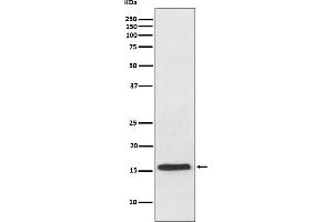 Western blot analysis of VAMP2 expression in mouse brain lysate. (Recombinant VAMP2 抗体)
