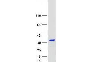 Western Blotting (WB) image for Kv Channel Interacting Protein 4 (KCNIP4) (Transcript Variant 1) protein (Myc-DYKDDDDK Tag) (ABIN2724033)