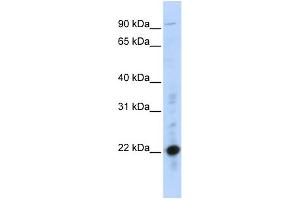WB Suggested Anti-CRIP2 Antibody Titration:  0. (CRIP2 抗体  (Middle Region))