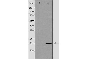 Western blot analysis of extracts of K562, using KLRD1 antibody. (CD94 抗体  (C-Term))