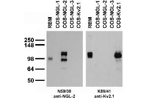 anti-Leucine Rich Repeat Containing 4 (LRRC4) (AA 550-652) antibody