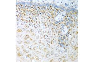 Immunohistochemistry of paraffin-embedded human esophagus using FDXR antibody at dilution of 1:100 (40x lens). (Ferredoxin Reductase 抗体)