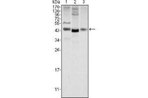 Western blot analysis using WNT1 mouse mAb against NIH/3T3 (1), 3T3L1 (2) and Hela (3) cell lysate. (WNT1 抗体)