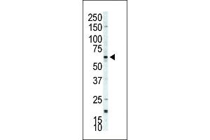 Western Blotting (WB) image for anti-Ribosomal Protein S6 Kinase, 70kDa, Polypeptide 2 (RPS6KB2) (AA 452-482), (C-Term) antibody (ABIN392546)