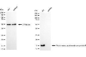 Western blotting analysis using vesicle associated membrane protein 8 antibody (ABIN7800832). (Recombinant VAMP8 抗体)