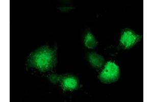 Anti-MAPRE2 mouse monoclonal antibody (ABIN2454543) immunofluorescent staining of COS7 cells transiently transfected by pCMV6-ENTRY MAPRE2 (RC200259). (MAPRE2 抗体)