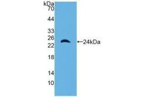Detection of Recombinant a1M, Mouse using Polyclonal Antibody to Alpha-1-Microglobulin (a1M) (AMBP 抗体  (AA 18-202))