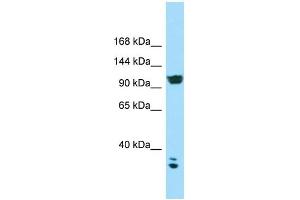 WB Suggested Anti-CACNA2D2 Antibody Titration: 1. (CACNA2D2 抗体  (C-Term))