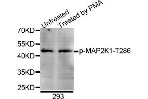 Western blot analysis of extracts of 293 cell line, using Phospho-MAP2K1-T286 antibody.