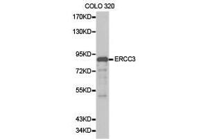 Western Blotting (WB) image for anti-DNA Repair Protein Complementing XP-B Cells (ERCC3) antibody (ABIN1872578) (ERCC3 抗体)
