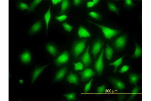 Immunofluorescence of monoclonal antibody to RAPGEF6 on HeLa cell. (RAPGEF6 抗体  (AA 1012-1110))
