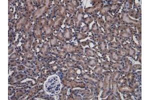 Detection of PARK7 in Mouse Kidney Tissue using Polyclonal Antibody to Parkinson Disease Protein 7 (PARK7) (PARK7/DJ1 抗体  (AA 1-189))