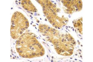 Immunohistochemistry of paraffin-embedded Human stomach using SCO2 Polyclonal Antibody at dilution of 1:100 (40x lens). (SCO2 抗体)