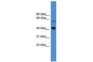 WB Suggested Anti-EIF2AK2  Antibody Titration: 0. (EIF2AK2 抗体  (Middle Region))