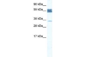 WB Suggested Anti-ZNF713 Antibody Titration:  1. (ZNF713 抗体  (N-Term))