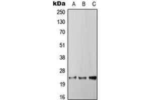 Western blot analysis of RGS4 expression in HepG2 (A), SP2/0 (B), PC12 (C) whole cell lysates. (RGS4 抗体  (Center))