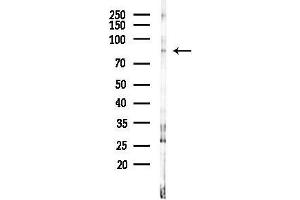 Western blot analysis of lysates from F10-LUC cells(heat-shock 45 min treatment), using 5 Lipoxygenase Antibody at 1/1000 dilution.