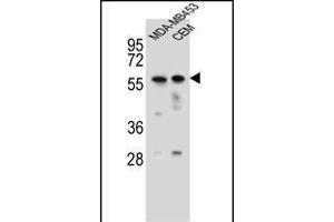 FOXD4 Antibody (Center) (ABIN656115 and ABIN2845454) western blot analysis in MDA-M,CEM cell line lysates (35 μg/lane). (FOXD4 抗体  (AA 182-210))