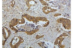 IHC analysis of RET using anti-RET antibody (ABIN6719502). (Ret Proto-Oncogene 抗体  (AA 29-304))