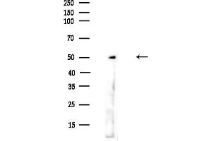 anti-Ferredoxin Reductase (FDXR) (C-Term) antibody