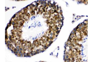 Immunohistochemistry (IHC) image for anti-WNK Lysine Deficient Protein Kinase 1 (WNK1) (AA 1154-1195), (Middle Region) antibody (ABIN4886765)