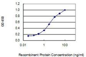 Detection limit for recombinant GST tagged WDR62 is 0. (WDR62 抗体  (AA 1-630))