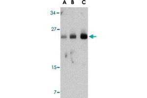 Western blot analysis of FABP7 in human breast tissue lysate with FABP7 polyclonal antibody  at (A) 0. (FABP7 抗体  (Internal Region))