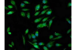 Immunofluorescence staining of Hela cells with ABIN7166993 at 1:100, counter-stained with DAPI. (RAB3GAP1 抗体  (Catalytic Subunit))