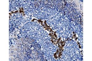 IHC analysis of CD38 using anti-CD38 antibody (ABIN7602815).