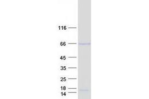 Western Blotting (WB) image for Adrenocortical Dysplasia Homolog (ACD) (Transcript Variant 1) protein (Myc-DYKDDDDK Tag) (ABIN2714315)
