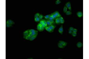 Immunofluorescence staining of HepG2 cells with ABIN7144688 at 1:133, counter-stained with DAPI. (Arylsulfatase E 抗体  (AA 352-494))