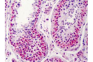 Anti-NEK2 antibody IHC of human testis. (NEK2 抗体  (AA 287-299))