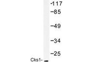 Western blot analysis of Cks1 antibody in extracts from Jurkat cells treated with serum 20% 15'. (CKS1 抗体)
