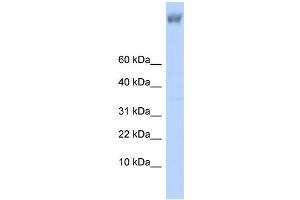 WB Suggested Anti-ZNF644 Antibody Titration:  0.