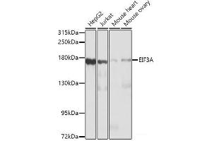Western blot analysis of extracts of various cell lines using EIF3A Polyclonal Antibody at dilution of 1:1000. (EIF3A 抗体)