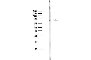 anti-Proteasome (Prosome, Macropain) 26S Subunit, Non-ATPase, 3 (PSMD3) (C-Term) antibody